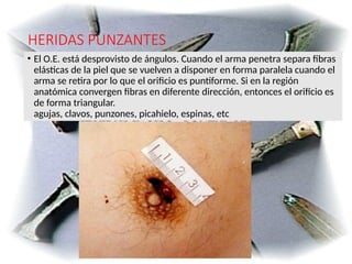 TEMA 5 HERIDAS POR ARMA BLANCA lesionologia.pptx