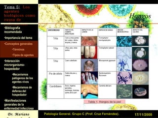 Hongos 17/11/2008 Patología General. Grupo C (Prof. Cruz Fernández). 