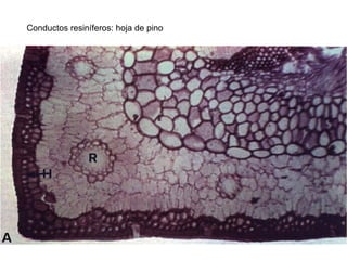 Conductos resiníferos: hoja de pino
 