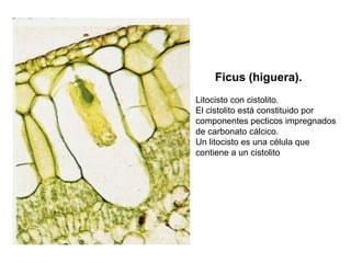 Ficus (higuera).
Litocisto con cistolito.
El cistolito está constituido por
componentes pecticos impregnados
de carbonato cálcico.
Un litocisto es una célula que
contiene a un cistolito
 