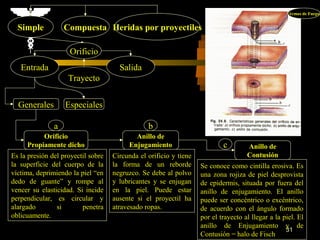 Armas de Fuego


  Simple           Compuesta Heridas por proyectiles

                    Orificio
   Entrada                            Salida
                    Trayecto


  Generales        Especiales

               a                                b
          Orificio                         Anillo de
     Propiamente dicho                   Enjugamiento                      c        Anillo de
Es la presión del proyectil sobre   Circunda el orificio y tiene                    Contusión
la superficie del cuerpo de la      la forma de un reborde         Se conoce como cintilla erosiva. Es
víctima, deprimiendo la piel “en    negruzco. Se debe al polvo     una zona rojiza de piel desprovista
dedo de guante” y rompe al          y lubricantes y se enjugan     de epidermis, situada por fuera del
vencer su elasticidad. Si incide    en la piel. Puede estar        anillo de enjugamiento. El anillo
perpendicular, es circular y        ausente si el proyectil ha     puede ser concéntrico o excéntrico,
alargado        si       penetra    atravesado ropas.              de acuerdo con el ángulo formado
oblicuamente.                                                      por el trayecto al llegar a la piel. El
                                                                   anillo de Enjugamiento y de
                                                                                                   31
                                                                   Contusión = halo de Fisch
 