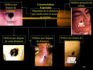 Orificio proyectil de
 Orificio por               Características                         rebote
 disparo de                   Especiales
  contacto             Dependen de la distancia
                       que media entre el arma y
                              la víctima




Orificio por disparo   Orificio por disparo        Orificio por disparo de
 de corta distancia        de distancia                larga distancia
                            intermedia




                                                                             36
 