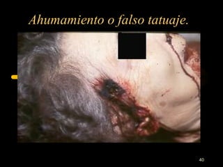 Ahumamiento o falso tatuaje.




                               40
 