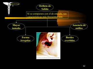 Armas de Fuego
                                  Orificio de
                                   Salida
                       Si se comparara con el de entrada, sus
                       características más frecuentes son:


   Mayor                                                         Ausencia de
  tamaño                                                           anillos


                  Forma                                     Bordes
                 irregular                                 evertidos




                                                                         42
 