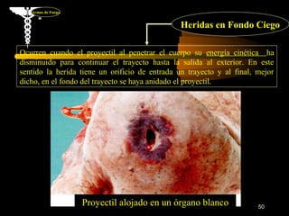 Armas de Fuego


                                                Heridas en Fondo Ciego

Ocurren cuando el proyectil al penetrar el cuerpo su energía cinética ha
disminuido para continuar el trayecto hasta la salida al exterior. En este
sentido la herida tiene un orificio de entrada un trayecto y al final, mejor
dicho, en el fondo del trayecto se haya anidado el proyectil.




                    Proyectil alojado en un órgano blanco              50
 