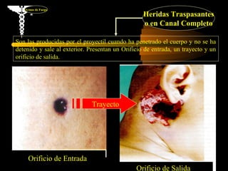 Armas de Fuego
                                                  Heridas Traspasantes
                                                  o en Canal Completo

Son las producidas por el proyectil cuando ha penetrado el cuerpo y no se ha
detenido y sale al exterior. Presentan un Orificio de entrada, un trayecto y un
orificio de salida.




                              Trayecto




    Orificio de Entrada
                                                                          51
                                               Orificio de Salida
 