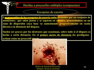 Armas de Fuego
                      Heridas a proyectiles múltiples (compuestas)

                                 Escopetas de cacería
Los proyectiles de las escopetas de cacería están formados por un conjunto de
municiones que salen juntos y se separan en abanico, proyectándose en un
cono de dispersión cuya base va aumentando progresivamente en razón
directa a la distancia del disparo.
Suelen ser graves por los destrozos que ocasionan, sobre todo si el disparo es
hecho a corta distancia. En el primer metro de distancia los perdigones
actúan como un proyectil simple.




                               Orificio de Entrada de Proyectiles       54
                                Múltiples. Distancia intermedia
 