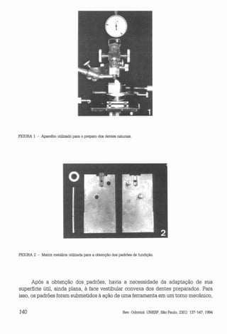 F1GURA 1 - Aparelho utilizado para o preparo dos dentes naturais.

F1GURA 2 - Matriz metálica utilizada para a obtenção dos padrões de fundição.

Após a obtenção dos. padrões, h~via a necessidade da adaptação de sua
superfície útil, ainda plana, à face vestibular convexa dos dentes preparados. Para
isso, os padrões foram submetidos à ação de uma ferramenta em um torno mecânico,
140

Rev. Odontol. UNESP, São Paulo, 23(1): 137-147, 1994

 
