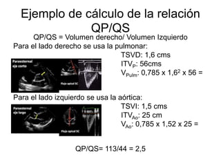 Hemodynamics through echocardiography | PPTX
