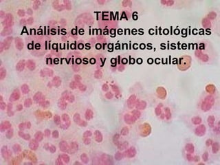 TEMA 6
Análisis de imágenes citológicas
de líquidos orgánicos, sistema
nervioso y globo ocular.
 