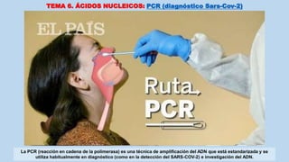 TEMA 6. ÁCIDOS NUCLEICOS: PCR (diagnóstico Sars-Cov-2)
La PCR (reacción en cadena de la polimerasa) es una técnica de amplificación del ADN que está estandarizada y se
utiliza habitualmente en diagnóstico (como en la detección del SARS-COV-2) e investigación del ADN.
 