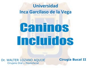 Universidad 
Inca 
Garcilaso 
de 
la 
Vega 
Dr. WALTER LOZANO AQUIJE 
Cirujano Oral y Maxilofacial 
Cirugía Bucal II 
 