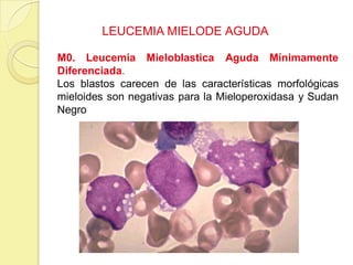 LEUCEMIA MIELODE AGUDA
M0. Leucemia Mieloblastica Aguda Mínimamente
Diferenciada.
Los blastos carecen de las características morfológicas
mieloides son negativas para la Mieloperoxidasa y Sudan
Negro
 