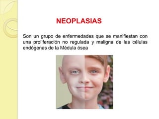 NEOPLASIAS
Son un grupo de enfermedades que se manifiestan con
una proliferación no regulada y maligna de las células
endógenas de la Médula ósea
 