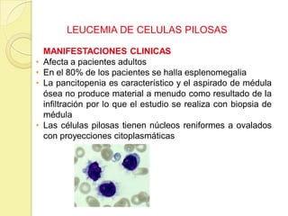 LEUCEMIA DE CELULAS PILOSAS
MANIFESTACIONES CLINICAS
• Afecta a pacientes adultos
• En el 80% de los pacientes se halla esplenomegalia
• La pancitopenia es característico y el aspirado de médula
ósea no produce material a menudo como resultado de la
infiltración por lo que el estudio se realiza con biopsia de
médula
• Las células pilosas tienen núcleos reniformes a ovalados
con proyecciones citoplasmáticas
 