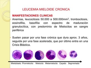 LEUCEMIA MIELOIDE CRONICA
MANIFESTACIONES CLINICAS
• Anemias, leucocitosis 50.000 a 500.000mm3, trombocitosis,
eosinofilia, basofilia con espectro de maduración
granulocítica, con predominio de Mielocitos en sangre
periférica
• Suelen pasar por una fase crónica que dura aprox. 3 años,
seguida por una fase acelerada, que por último entra en una
Crisis Blástica.
Mieloblasto Promielocito Mielocito Metamielocito Cayado Segmentado
 