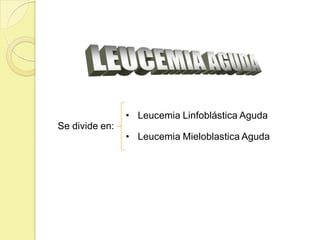 • Leucemia Linfoblástica Aguda
Se divide en:
• Leucemia Mieloblastica Aguda
 