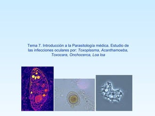 Tema 7. Introducción a la Parasitología médica. Estudio de las infecciones oculares por:  Toxoplasma ,  Acanthamoeba, Toxocara, Onchocerca, Loa loa 