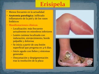 Erisipela
• Menos frecuente en la actualidad
• Anatomía patológica: infiltrado
inflamatorio de la piel y de los vasos
linfáticos
• Manifestaciones clínicas
– Localización: más frecuente
actualmente en miembros inferiores
– Lesión cutánea localizada con
induración, enrojecimiento, borde
palpable y dolorosa
– Se inicia a partir de una lesión
superficial que progresa en 4-6 días.
– Inicio agudo con fiebre y síntomas
generales
– Descamación y despigmentación
tras la resolución de la placa

 