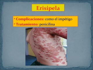 Erisipela
• Complicaciones: como el impétigo
• Tratamiento: penicilina

 