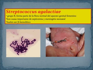 Streptococcus agalactiae

• grupo B, forma parte de la flora normal del aparato genital femenino
•Son causa importante de septicemia y meningitis neonatal
•Suelen ser β-hemolítico

 