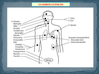 CUADROS CLINICOS

 