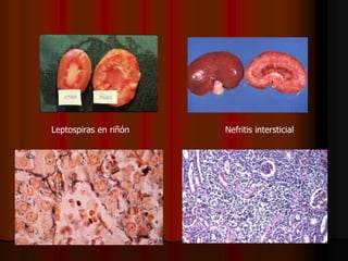 Leptospirosis canina Medicina Veterinaria | PDF