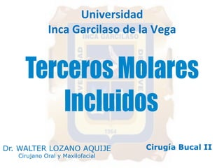 Universidad 
Inca 
Garcilaso 
de 
la 
Vega 
Dr. WALTER LOZANO AQUIJE 
Cirujano Oral y Maxilofacial 
Cirugía Bucal II 
 