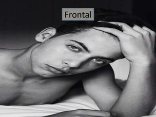 Frontal 
 