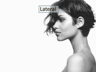Lateral 
 