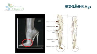 E
R
G
O
N
O
M
Ť
AE
NE
LH
o
g
ar
 