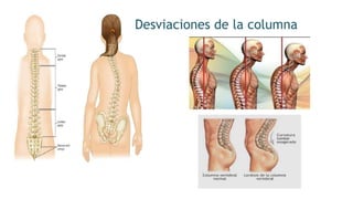 Desviaciones de la columna
 