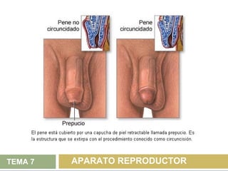 TEMA 7   APARATO REPRODUCTOR
 
