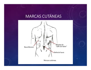 Tema 8 columa lumbar | PDF