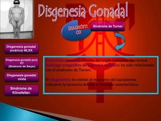 TEMA 8 DISFUNCION Y DISGENESIA GONADAL-1.pptx