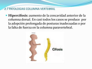 2.2 ESTRUCTURA Formada por 33 vertebras separadas por discos intervertebrales: 7 cervicales(en región cuello), 12 dorsales o torácicas (en región posterior caja torácica), 5 lumbares(soporte de la porción inferior de la espalda), 5 sacras fusionadas formando el hueso sacro y 4 coxígeas formando el hueso coxis.