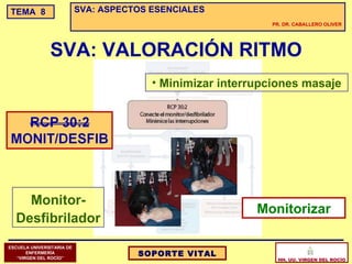 Sva Display SVA: ASPECTOS ESENCIALES | PPT