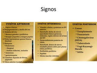 Signos
 