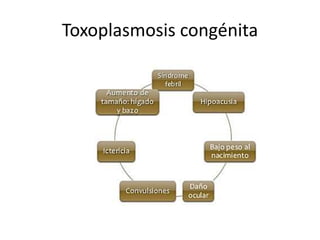 Toxoplasmosis congénita
 