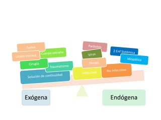 Exógena Endógena
 