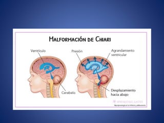 TEMA_8_VENTRICULOS_LATERALES.pptx