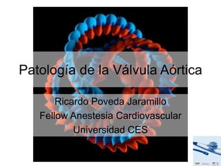 Patología de la Válvula Aórtica
Ricardo Poveda Jaramillo
Fellow Anestesia Cardiovascular
Universidad CES
 