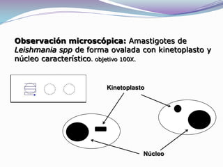 Observación microscópica: Amastigotes de Leishmania spp de forma ovalada con kinetoplasto y núcleo característico. objetivo 100X.KinetoplastoNúcleo