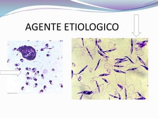        AGENTE ETIOLOGICO
