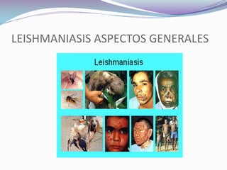 LEISHMANIASIS ASPECTOS GENERALES