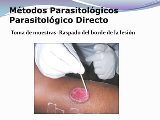 EXAMEN PARASITOLOGICO DIRECTO 