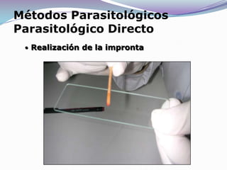 Métodos ParasicológicosParasitológico DirectoDetección de amastigotes en muestras obtenidas por raspado del borde de las lesiones cutáneas, teñidas por Giemsa.MaterialesMétodos ParasitológicosParasitológico DirectoToma de muestras: Raspado del borde de la lesión