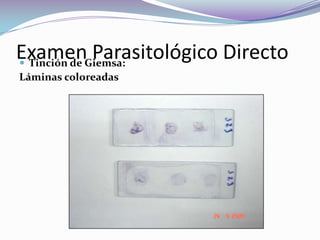 Métodos ParasitológicosParasitológico Directo Realización de la improntaExamen Parasitológico DirectoTinción de Giemsa: Láminas coloreadas