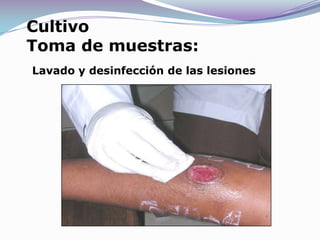 CultivoToma de muestras:Lavado y desinfección de las lesiones