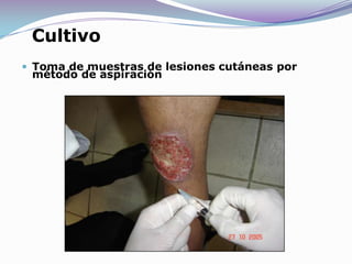 Cultivo Toma de muestras de lesiones cutáneas por método de aspiración